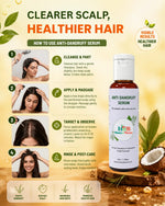 Load image into Gallery viewer, Anti Dandruff Serum 50ml