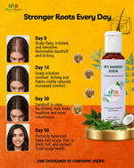 Load image into Gallery viewer, Anti Dandruff Serum 50ml
