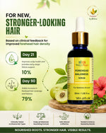 Load image into Gallery viewer, Forehead Baldness Serum 30ml
