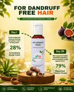 Load image into Gallery viewer, Anti Dandruff Serum 50ml
