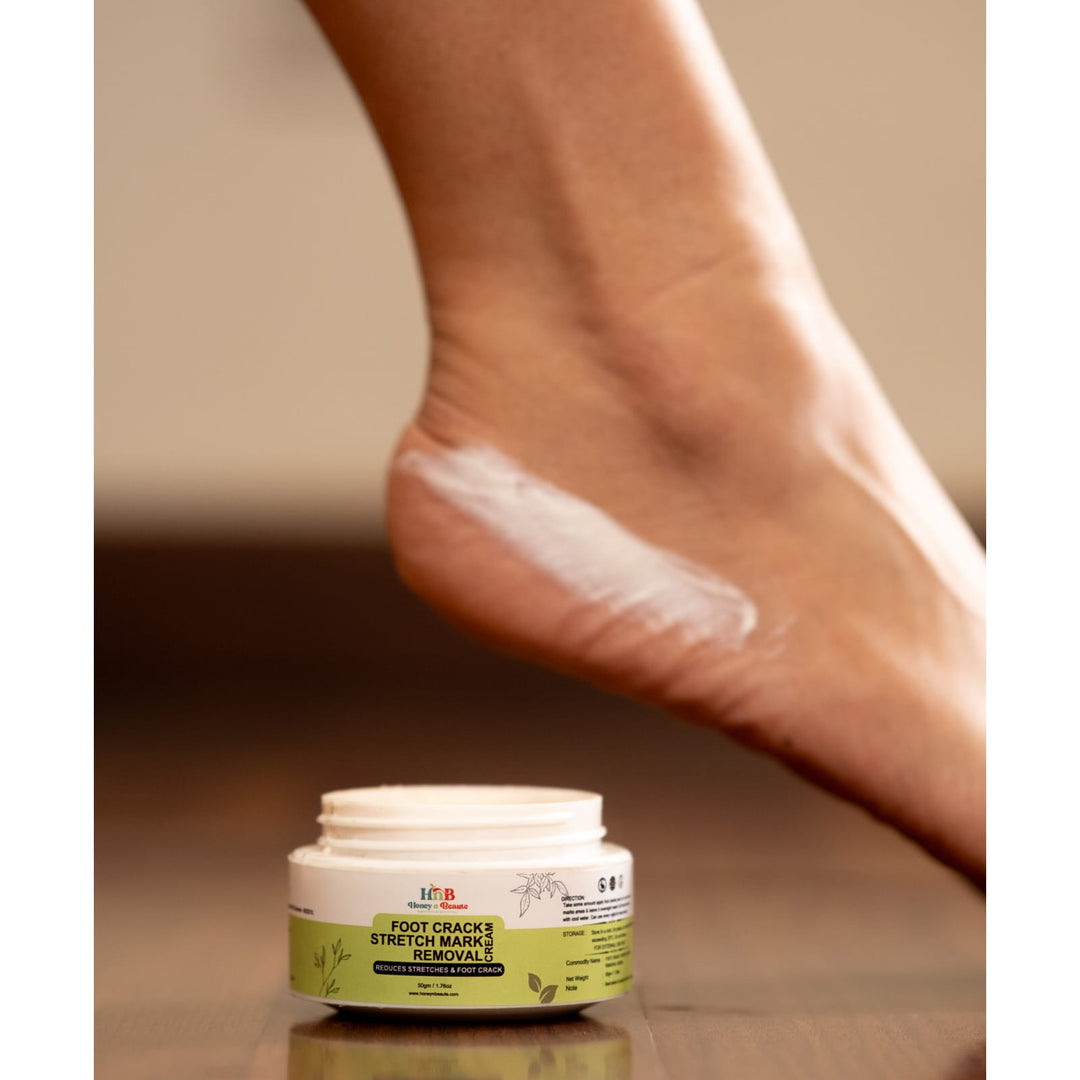Foot crack / stretch mark removal cream 50g