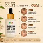 Load image into Gallery viewer, Emergency Acne Serum
